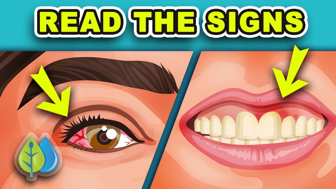 Signs of vitamin deficiency – Artofit